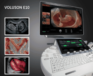 Promotional image of GE Voluson E10