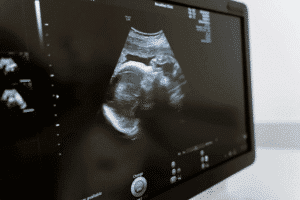 Sonography clinic melbourne