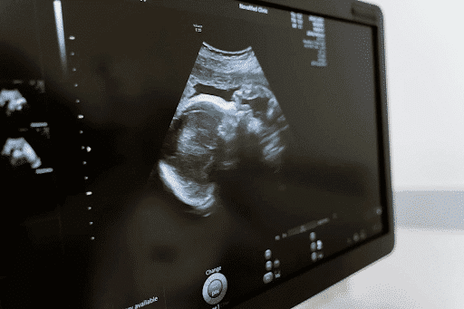 Sonography clinic melbourne